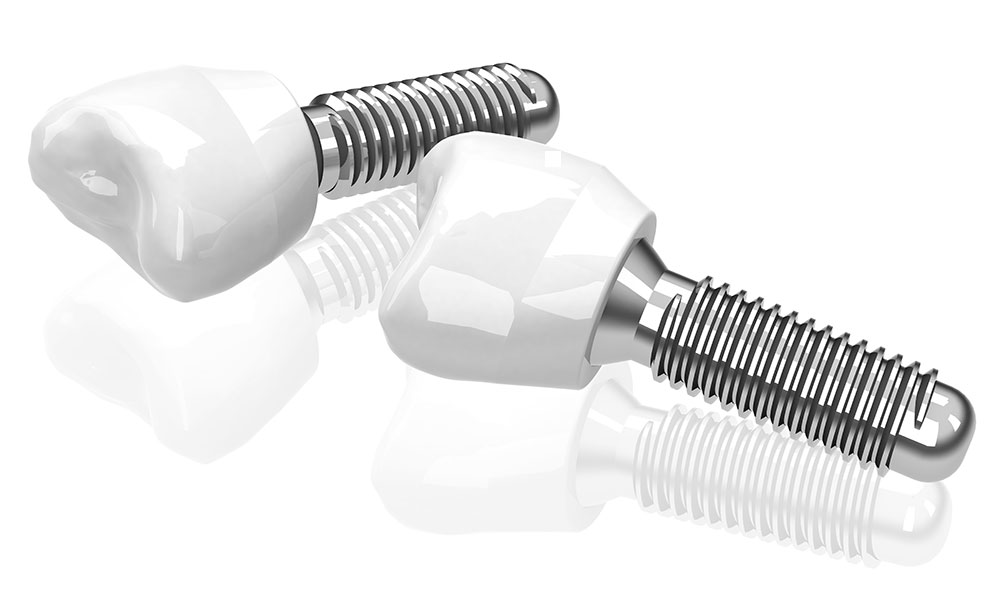 Dr. med. Gerd Wohlrab - MKG Dr. med. Gerd Wohlrab - MKG